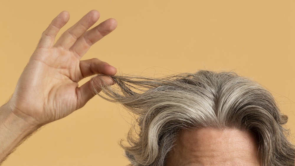 Uomo che si tiene i capelli per far vedere che sta perdendo i capelli